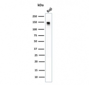 Western blot testing of human Raji cell lysate with CD22 antibody (clone BLCAM/1796). Expected molecular weight: 76-150 kDa depending on glycosylation level.