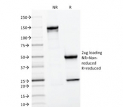 SDS-PAGE analysis of purified, BSA-free CD22 antibody (clone BLCAM/1796) as confirmation of integrity and purity.