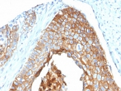 IHC staining of FFPE human cervix with CD9 antibody (clone CD9/2343). HIER: boil tissue sections in pH6, 10mM citrate buffer, for 10-20 min followed by cooling at RT for 20 min.