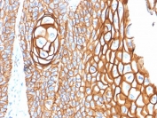 IHC staining of FFPE human skin with CD9 antibody (clone CD9/2343). HIER: boil tissue sections in pH6, 10mM citrate buffer, for 10-20 min followed by cooling at RT for 20 min.