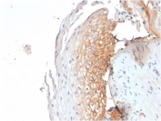 IHC staining of FFPE human tonsil with CD9 antibody (clone CD9/1619). HIER: boil tissue sections in pH6, 10mM citrate buffer, for 10-20 min followed by cooling at RT for 20 min.