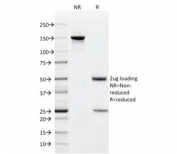 SDS-PAGE analysis of purified, BSA-free CD9 antibody (clone CD9/1619) as confirmation of integrity and purity.