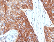 IHC staining of FFPE human cervical tissue with CD9 antibody (clone CDLA9-1). HIER: boil tissue sections in pH6, 10mM citrate buffer, for 10-20 min followed by cooling at RT for 20 min.
