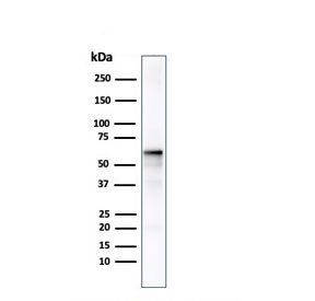 Western blot testing of human MCF7 cell lysate with AKT1 antibody. Predicted molecular weight ~56 kDa.~