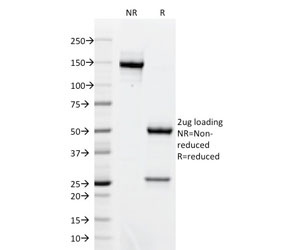 SDS-PAGE analysis of purified, BSA-free AKT1 antibody (clone AKT1/2491) as confirmation of integrity and purity.