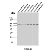 AKT1 Antibody Tissue WB. Western blot analysis of human brain, kidney, liver, lung, pancreas, skeletal muscle, and spleen tissue lysates using AKT1 antibody (clone AKT1/2491) detects a band at approximately 55-60 kDa, consistent with the predicted molecular weight of AKT1, with broad expression observed across tissues.