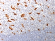 IHC staining of FFPE human tonsil with CD68 antibody (LAMP4/1830). HIER: boil tissue sections in pH6, 10mM citrate buffer, for 10-20 min followed by cooling at RT for 20 min.