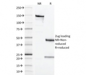 SDS-PAGE analysis of purified, BSA-free CD68 antibody (clone LAMP4/1830) as confirmation of integrity and purity.