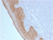IHC testing of FFPE human tonsil tissue with Beta Catenin antibody (clone CTNNB1/2098). HIER: boil tissue sections in pH 9 10mM Tris with 1mM EDTA for 20 min and allow to cool before testing.