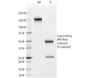 SDS-PAGE analysis of purified, BSA-free CD79b antibody (clone IGB/1842) as confirmation of integrity and purity.