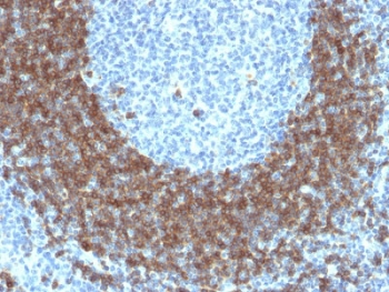 IHC testing of FFPE human tonsil tissue with CD79b antibody (clone IGB/1842). HIER: boil tissue sections in pH 9 10mM Tris with 1mM EDTA for 10-20 min followed by cooling at RT for 20 min.~