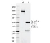 SDS-PAGE analysis of purified, BSA-free Bcl6 antibody (clone BCL6/1718) as confirmation of integrity and purity.