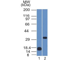Western blot testing of 1) partial recombinant protein and 2) human Raji cell lysate with CD79b antibody (clone IGB/1843). Expected molecular weight: 26-39 kDa depending on glycosylation level.~