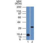 Western blot testing of 1) partial recombinant protein and 2) human Raji cell lysate with CD79b antibody (clone IGB/1843). Expected molecular weight: 26-39 kDa depending on glycosylation level.