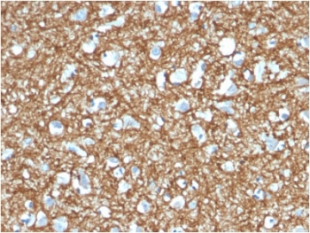 IHC testing of FFPE human brain with p14ARF antibody (clone 4C6/4). HIER: boil tissue sections in pH6, 10mM citrate buffer, for 10-20 min followed by cooling at RT for 20 min.~