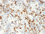 IHC testing of FFPE human kidney tissue with AIF1 antibody (clone AIF1/2493). HIER: boil tissue sections in pH6, 10mM citrate buffer, for 10-20 min followed by cooling at RT for 20 min.