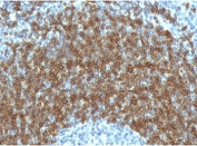 IHC testing of FFPE human tonsil tissue with CD79b antibody (clone CDLA79b-1). HIER: boil tissue sections in pH6, 10mM citrate buffer, for 10-20 min followed by cooling at RT for 20 min.
