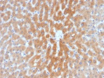 IHC testing of FFPE human liver tissue with ARF1 antibody (clone 1A9/5). HIER: boil tissue sections in pH6, 10mM citrate buffer, for 10-20 min followed by cooling at RT for 20 min.~