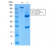 SDS-PAGE analysis of purified, BSA-free recombinant Basic Cytokeratin antibody (clone KRTH/2147R) as confirmation of integrity and purity.