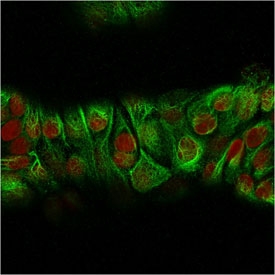 Immunofluorescent staining of MeOH-fixed human MCF7 cells with recombinant Basic Cytokeratin antibody (green, clone KRT18/834) and Reddot nuclear stain (red).~