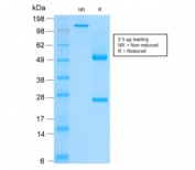 SDS-PAGE analysis of purified, BSA-free recombinant Basic Cytokeratin antibody (clone rKRTH/2148) as confirmation of integrity and purity.