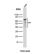 Western blot analysis of p63 expression. Whole cell lysate from human A431 cells was analyzed by SDS-PAGE and immunoblotting using recombinant p63 antibody (clone TP63/1423R). A prominent band is detected at the predicted molecular weight range corresponding to p63, consistent with expression of p63 isoforms in A431 cells.