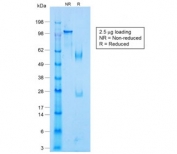 SDS-PAGE analysis of purified, BSA-free recombinant p63 antibody (clone TP63/1423R) as confirmation of integrity and purity.