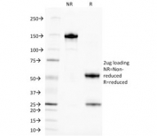 SDS-PAGE analysis of purified, BSA-free ALK antibody (clone ALK/1504) as confirmation of integrity and purity.