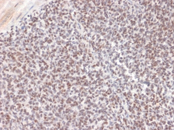 IHC testing of FFPE Ewing's Sarcoma with