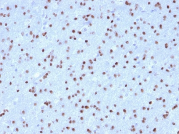 IHC testing of FFPE human cerebellum with OLIG2 antibody (clone OLIG2/2400). HIER: boil tissue sections in pH 9 10mM Tris with 1mM EDTA for 10-20 min followed by cooling at RT for 20 min.~