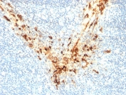 IHC testing of FFPE human tonsil with Mesothelin antibody (clone MSLN/2131). HIER: boil tissue sections in pH 9 10mM Tris with 1mM EDTA for 10-20 min followed by cooling at RT for 20 min.