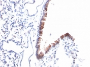 IHC testing of FFPE mouse lung with Mesothelin antibody (clone MSLN/2131). HIER: boil tissue sections in pH 9 10mM Tris with 1mM EDTA for 10-20 min followed by cooling at RT for 20 min.