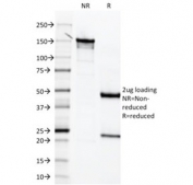 SDS-PAGE analysis of purified, BSA-free Mesothelin antibody (clone MSLN/2131) as confirmation of integrity and purity.