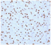 IHC testing of FFPE human cerebellum with OLIG2 antibody (clone ODTF2-1). HIER: boil tissue sections in pH 9 10mM Tris with 1mM EDTA for 10-20 min followed by cooling at RT for 20 min.