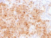 IHC analysis of FFPE human parathyroid gland stained with recombinant Chromogranin A antibody (CHGA/1731R). Required HIER: steam sections in pH6 citrate buffer for 10-20 min.