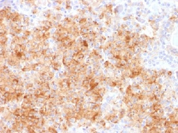IHC analysis of FFPE human parathyroid gland stained with recombinant
