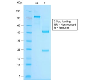 SDS-PAGE analysis of purified, BSA-free recombinant Chromogranin