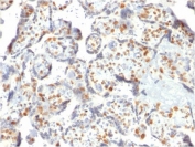 IHC testing of FFPE human placenta with Dnmt3a antibody. Required HIER: boil sections in 1mM EDTA, pH 9, for 10-20 min and allow to cool before testing.