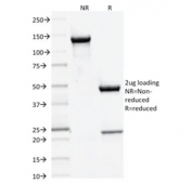 SDS-PAGE analysis of purified, BSA-free Dnmt3a antibody as confirmation of integrity and purity.