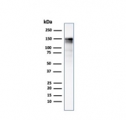 Western blot testing of A431 lysate using EGFR antibody (clone GFR/2341). Expected molecular weight: 134-180 kDa depending on glycosylation level.