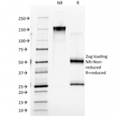 SDS-PAGE analysis of purified, BSA-free EGFR antibody (clone GFR/2341) as confirmation of integrity and purity.