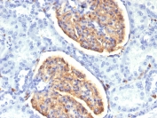 IHC testing of FFPE human kidney tissue with IBA1 antibody (clone AIF1/1909). HIER: boil tissue sections in pH6, 10mM citrate buffer, for 10-20 min followed by cooling at RT for 20 min.