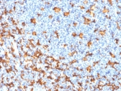 IHC testing of FFPE human tonsil with recombinant IBA1 antibody (clone rAIF1/1909). HIER: boil tissue sections in pH6, 10mM citrate buffer, for 10-20 min followed by cooling at RT for 20 min.