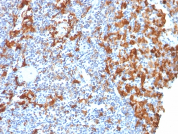 IHC testing of FFPE human lymph node with recombinant IBA1 antibody (clone rAIF1/1909). HIER: boil tissue sections in pH6, 10mM citrate buffer, for 10-20 min followed by cooling at RT for 20 min.~