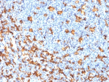 IHC testing of FFPE human tonsil with re