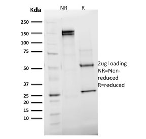 SDS-PAGE analysis of purified, BSA-free Emerin antibody (clone EMD/2168) as confirmation of integrity and purity.