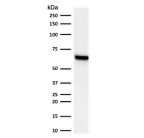 Western blot testing of human MCF-7 lysate with Estrogen Receptor alpha antibody (clone NR3Ga-2). Expected molecular weight ~67 kDa.~