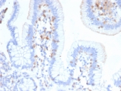 IHC testing of FFPE human small intestine with CD103 antibody (clone ITGAE/2474). HIER: boil tissue sections in pH9, 1mM EDTA buffer, for 10-20 min followed by cooling at RT for 20 min.