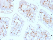 IHC testing of FFPE human colon with CD103 antibody (clone ITGAE/2474). HIER: boil tissue sections in pH9, 1mM EDTA buffer, for 10-20 min followed by cooling at RT for 20 min.