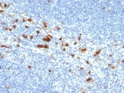 IHC testing of FFPE human tonsil with CD103 antibody (clone ITGAE/2474). HIER: boil tissue sections in pH9, 1mM EDTA buffer, for 10-20 min followed by cooling at RT for 20 min.